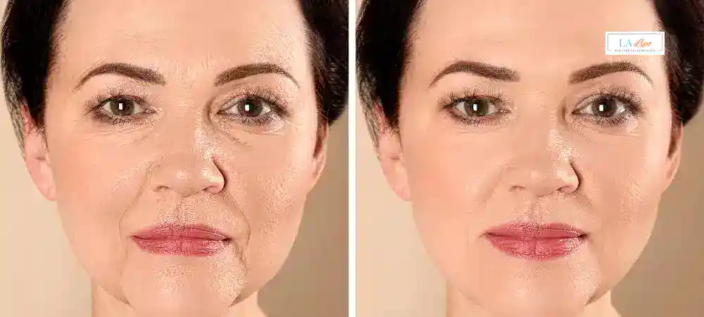 Why Aren’t My Skincare Products Making My Sagging Skin Look Firmer Buckingham?