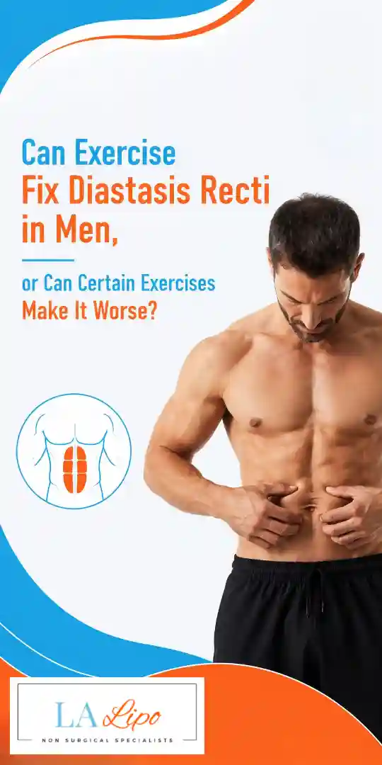 Can Exercise Fix Diastasis Recti in Men, or Can Certain Exercises Make It Worse Buckingham?